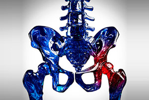Hip Pain Treatment in Gurugram